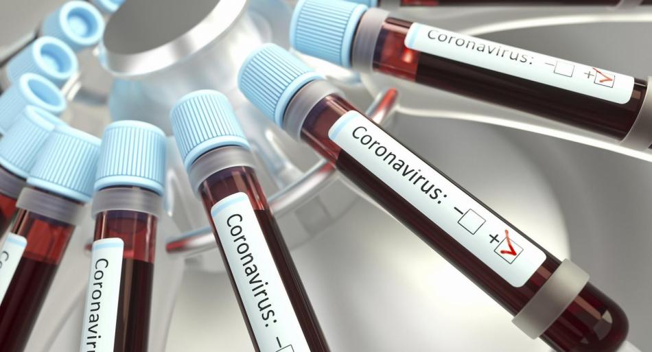 Анализ на антитела к коронавирусу IGG и IGM.
