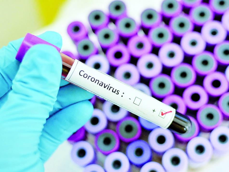 Сколько стоит анализ на антитела к коронавирусу (Covid)?
